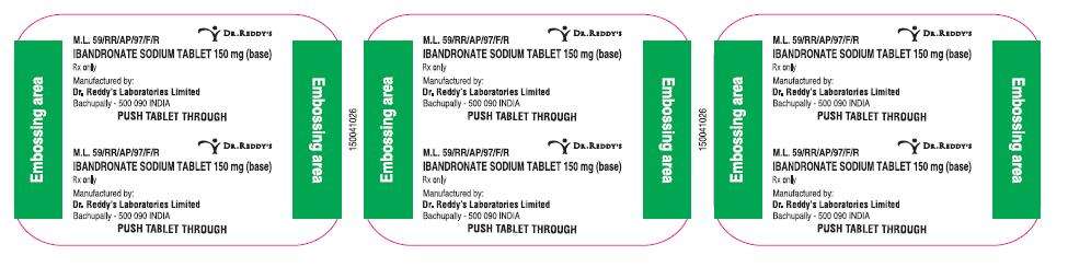 Ibandronate sodium