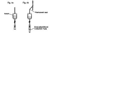 TERUFLEX Blood Bag System with Diversion Blood Sampling Arm Anticoagulant Citrate Phosphate Dextrose (CPD) AND OPTISOL (AS-5) Red Cell Preservative