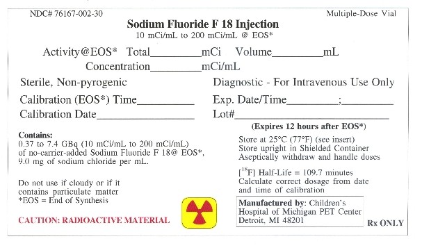 Sodium FluorideF 18