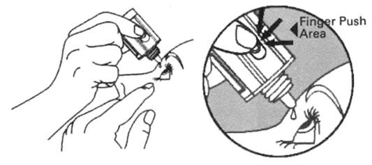 Timoptic-XE