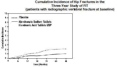 Alendronate Sodium