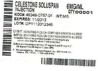 CELESTONE SOLUSPAN