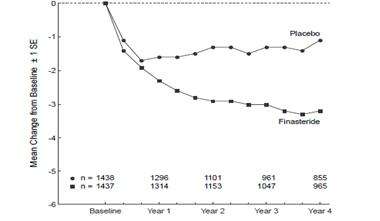 Finasteride