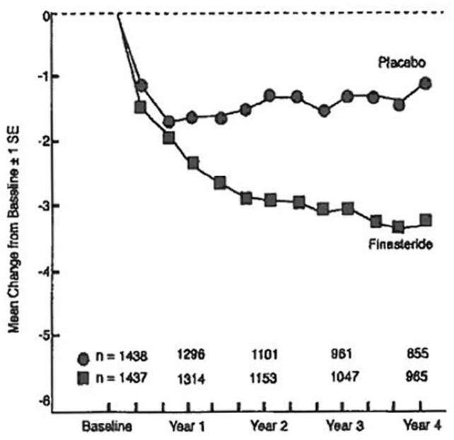 Finasteride