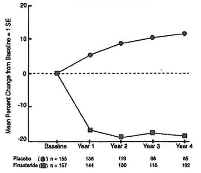 Finasteride