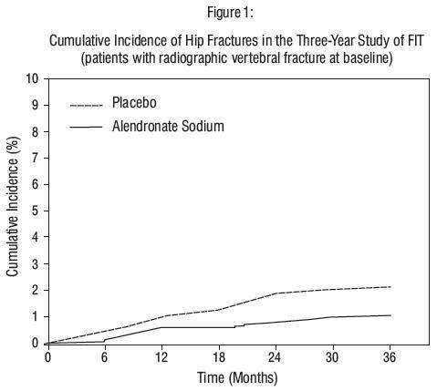 Alendronate Sodium