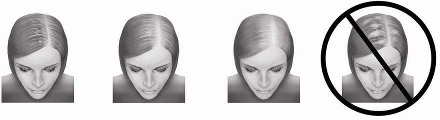 Equaline Hair Regrowth Treatment