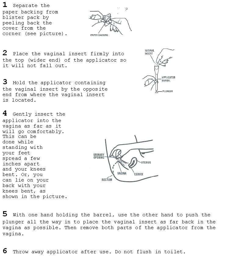 smart sense miconazole 1