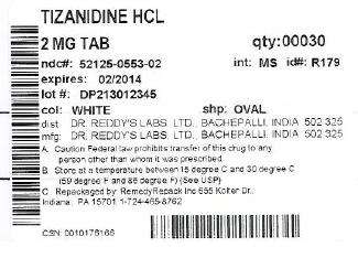 Tizanidine