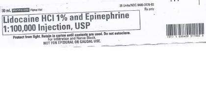 Lidocaine Hydrochloride and Epinephrine