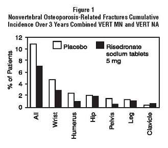 Risedronate Sodium
