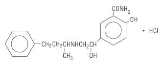 Labetalol Hydrochloride