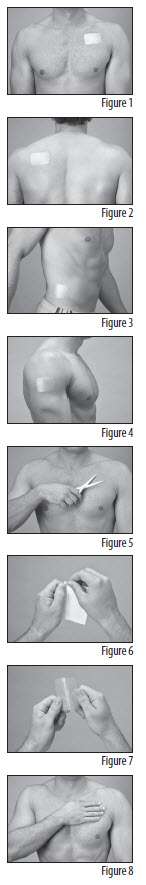 FENTANYL TRANSDERMAL SYSTEM