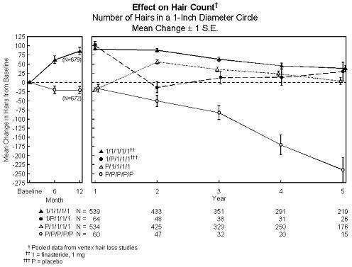 Finasteride