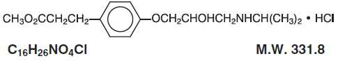 Esmolol Hydrochloride