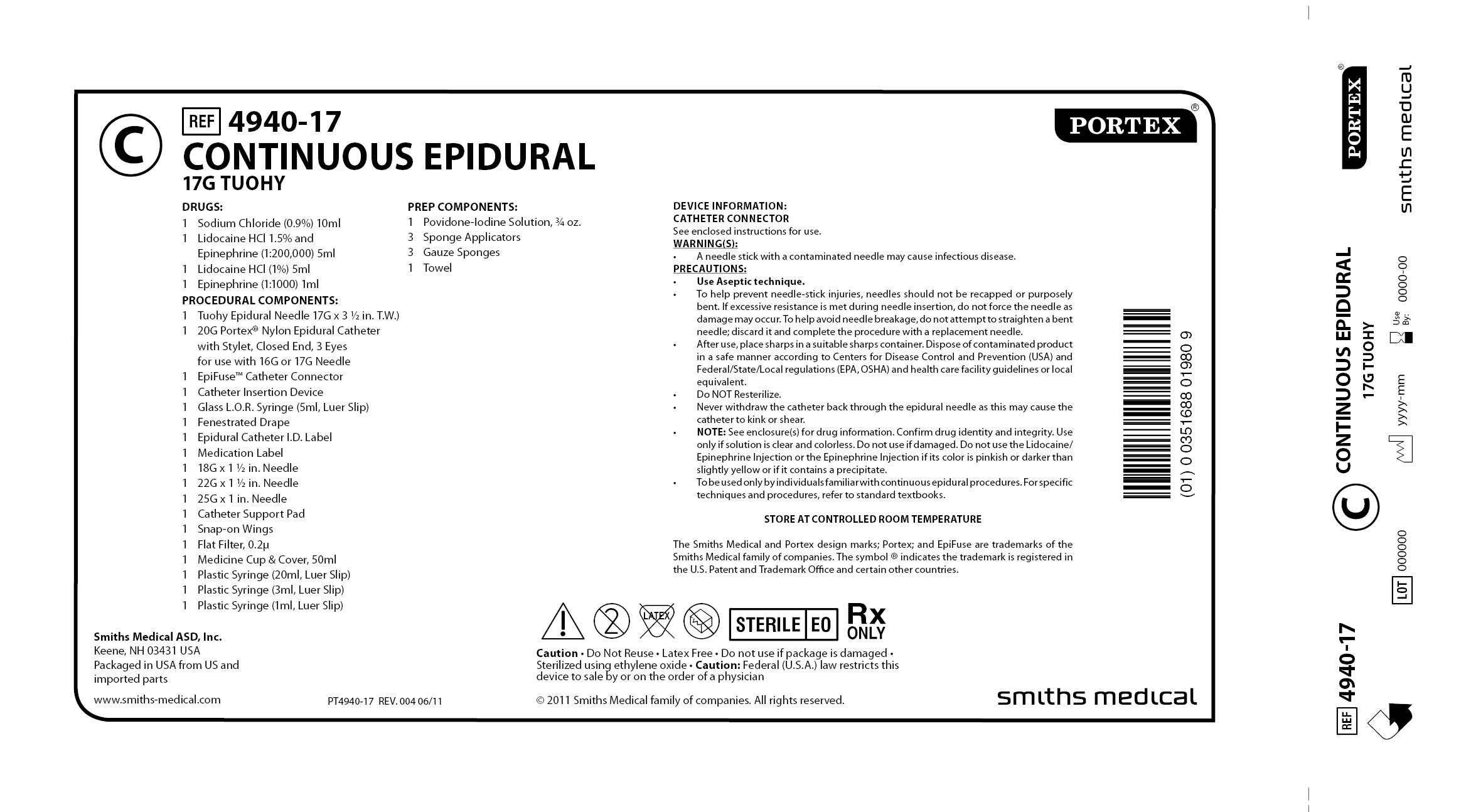 4940-17 CONTINUOUS EPIDURAL 17G TUOHY