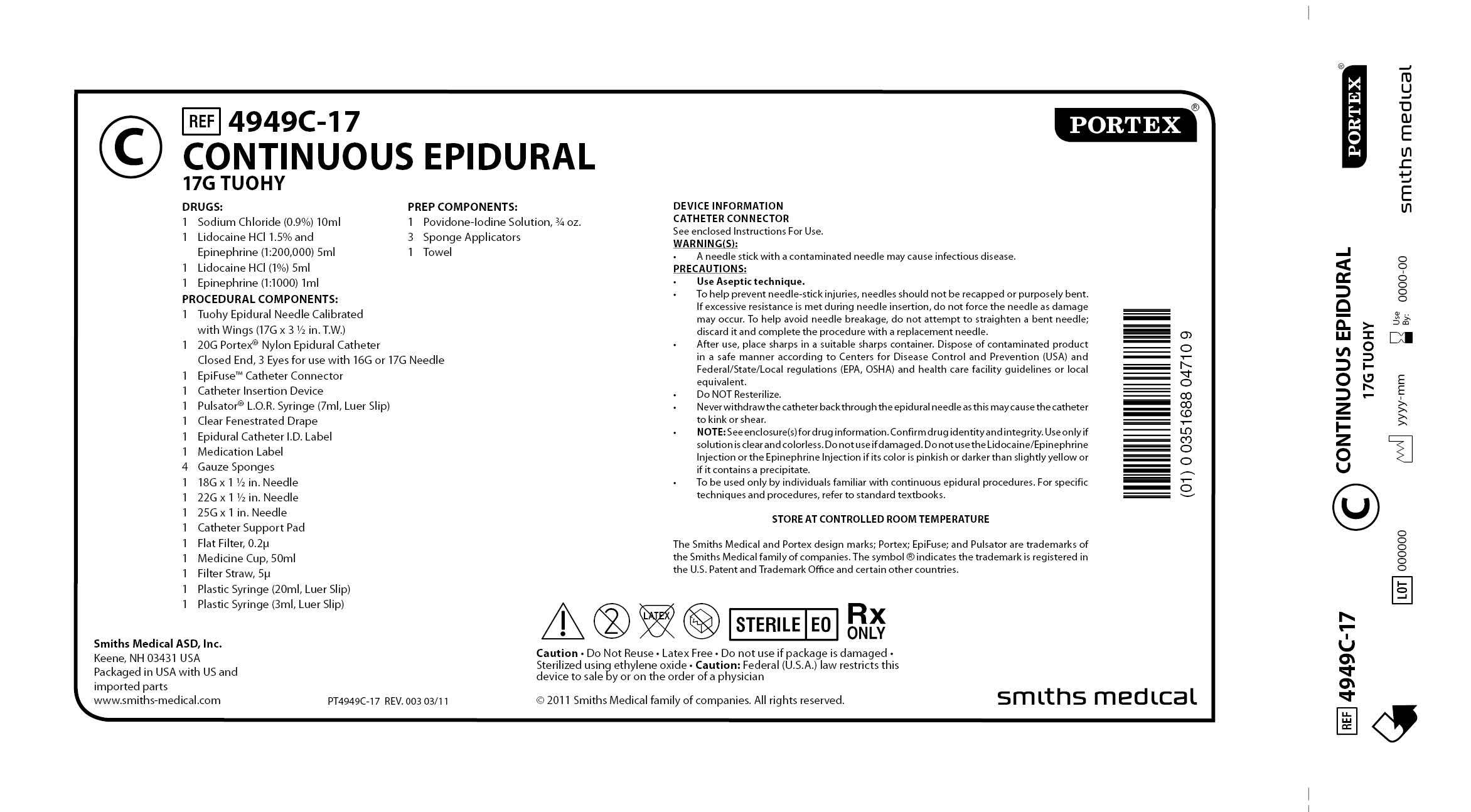 4949C-17 CONTINUOUS EPIDURAL 17G TUOHY