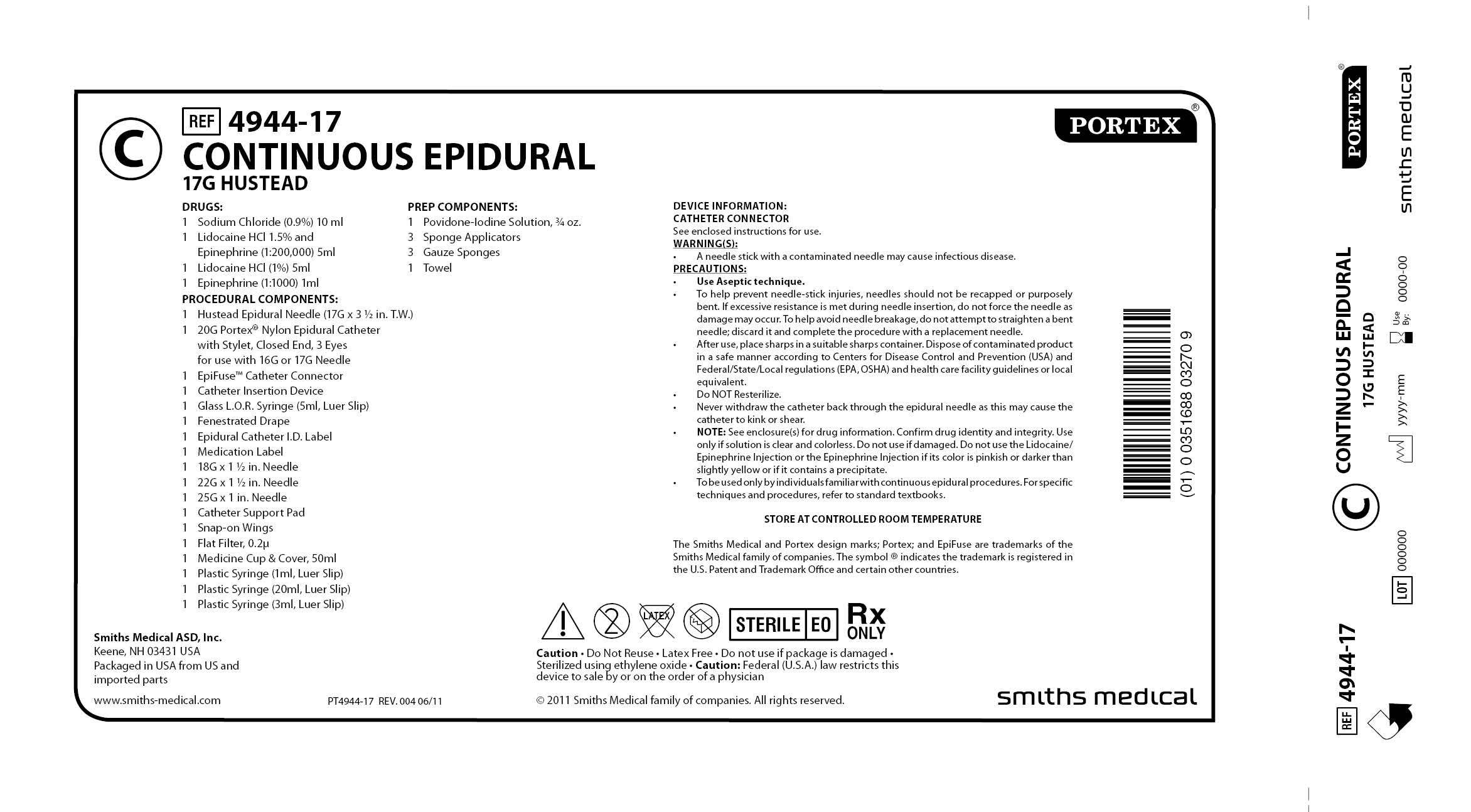 4944-17 CONTINUOUS EPIDURAL 17G HUSTEAD