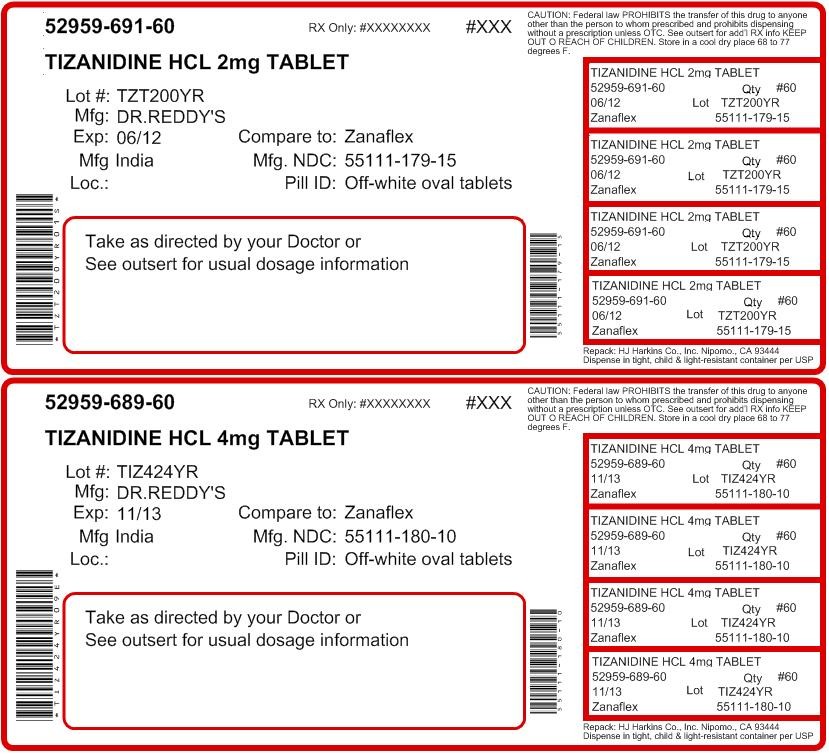 Tizanidine