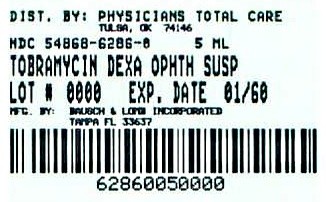 Tobramycin and Dexamethasone