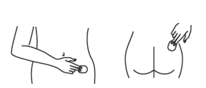 Estradiol Transdermal System