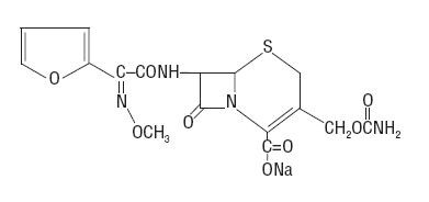 Cefuroxime Sodium