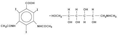 Hypaque Sodium