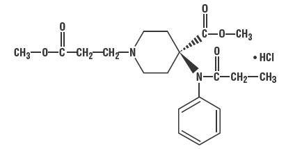 Ultiva